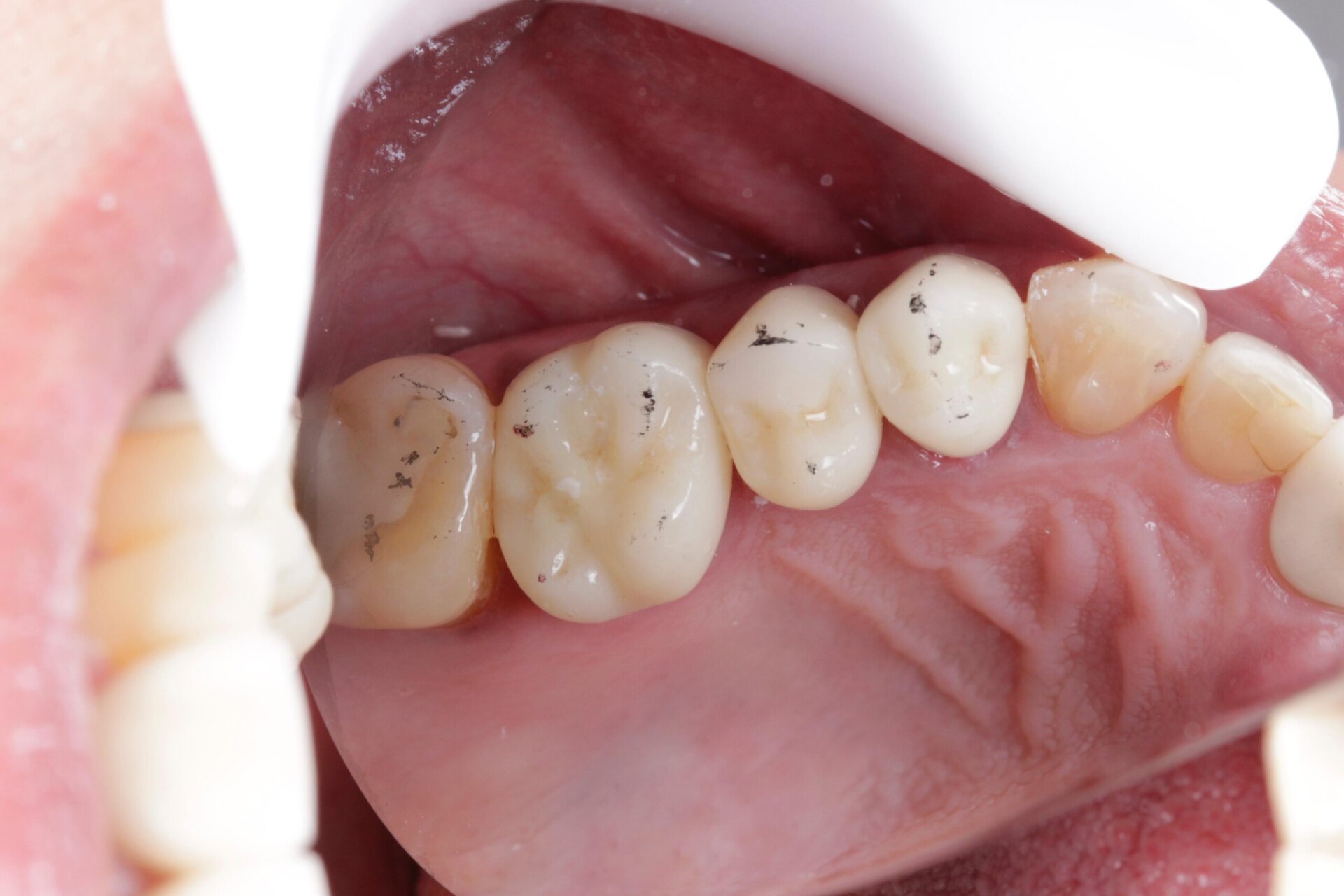 WhatsApp Image 2024-05-17 at 11.11.22 (2)