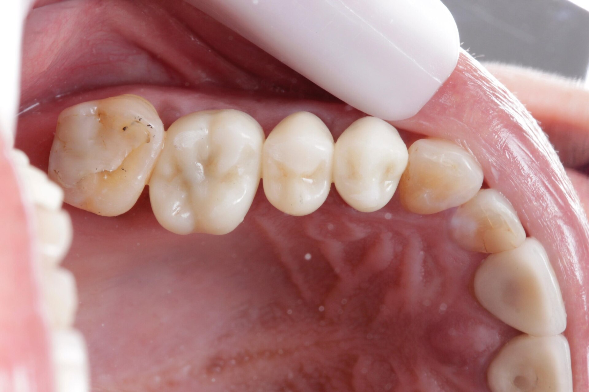 WhatsApp Image 2024-05-17 at 11.11.22 (3)