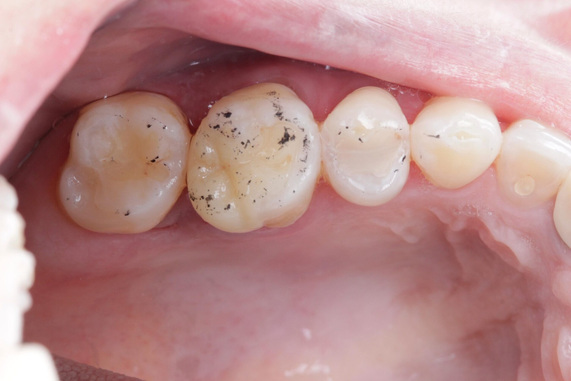 WhatsApp Image 2024-05-17 at 11.11.22 (8)