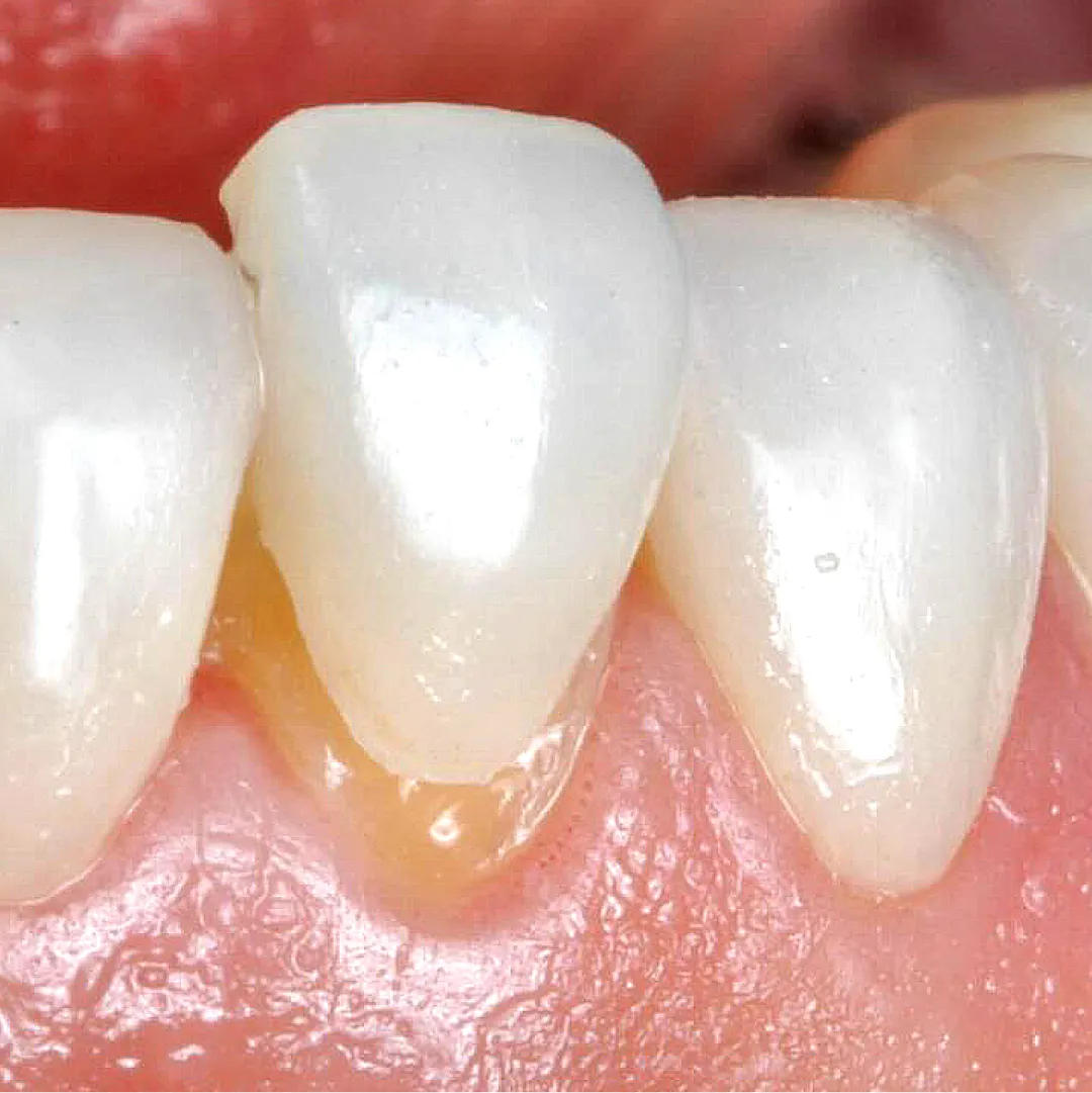 Prancheta 1 cópia 16 (3)