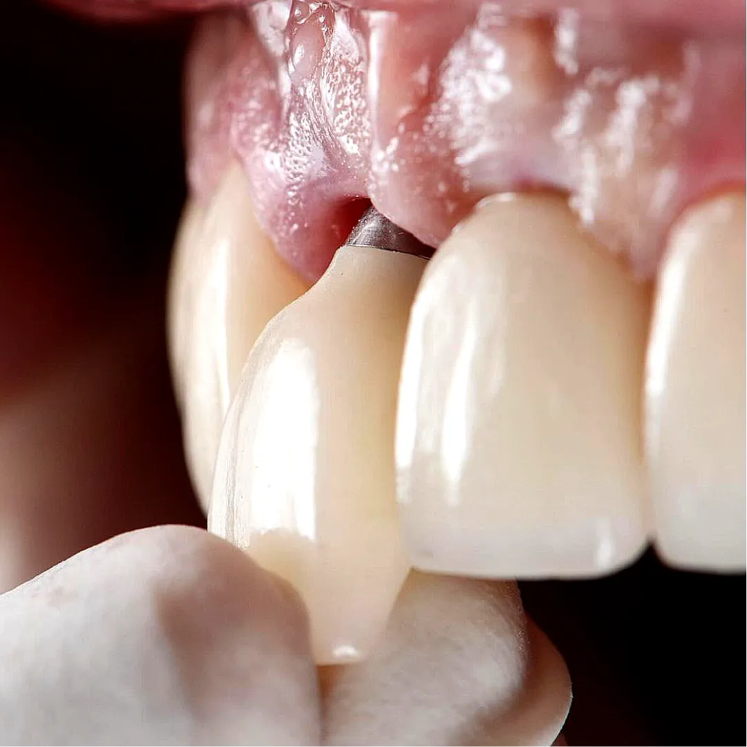 Prancheta 1 cópia 16 (4)