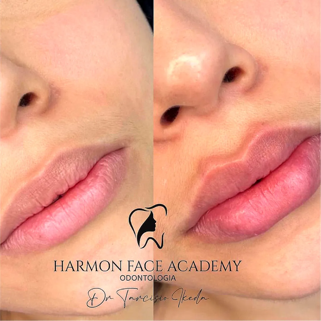 Prancheta 1 cópia 24 (2)