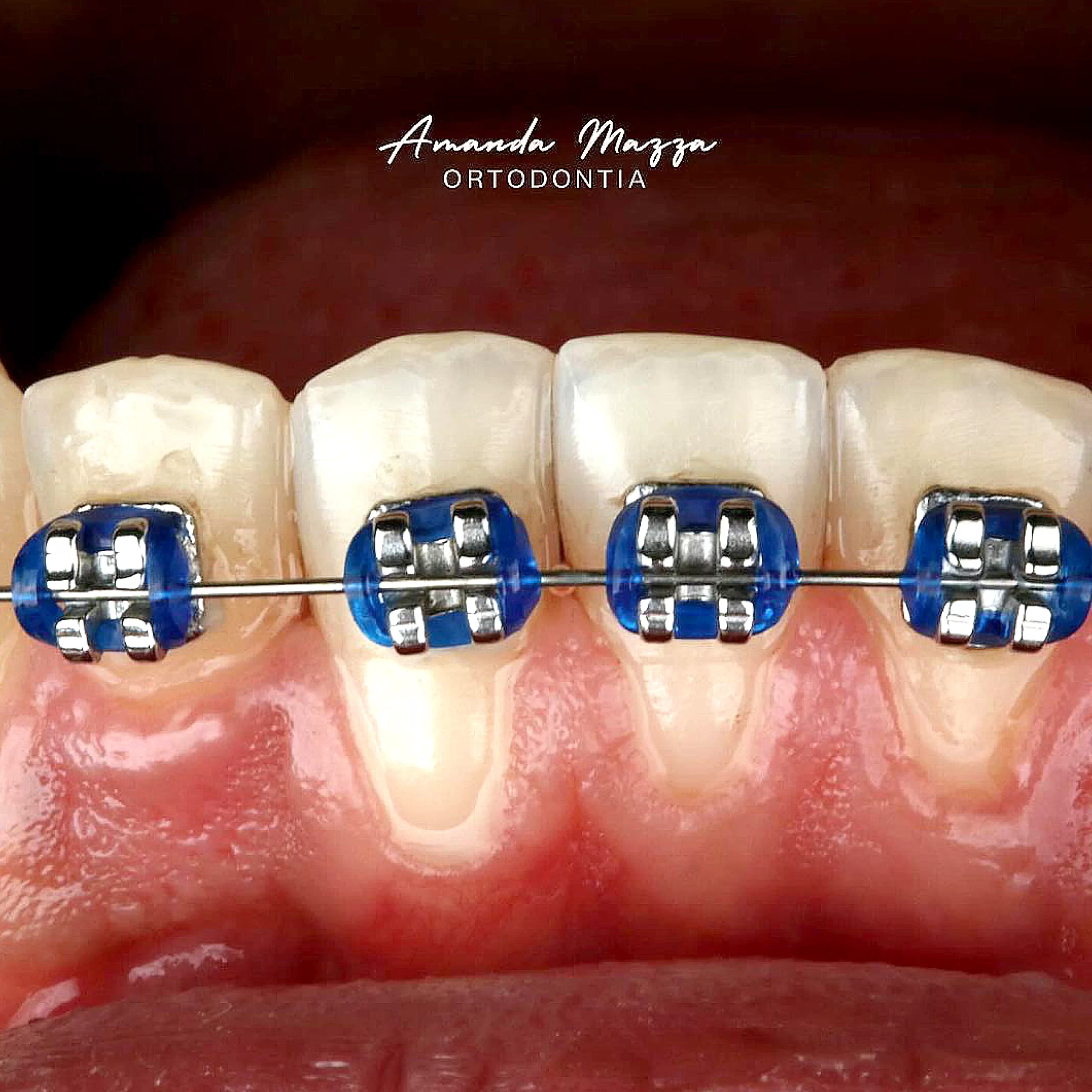 Sem título-1_Prancheta 1 cópia 2 (6)